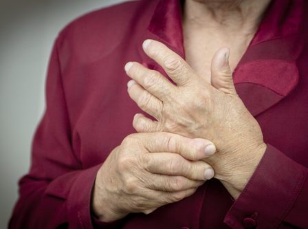 Artrite reumatoide: origine, sintomi e cure