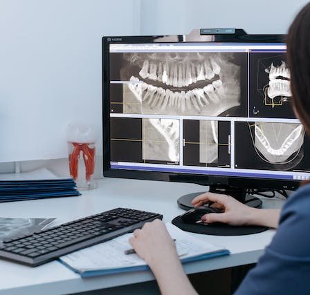 Faccette dentali: come ripristinare il proprio sorriso