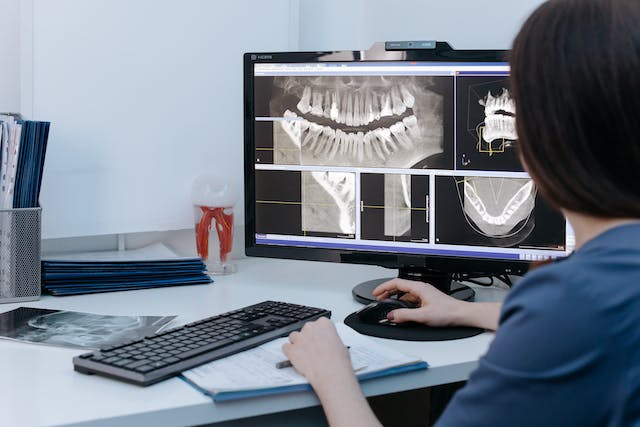 Faccette dentali: come ripristinare il proprio sorriso