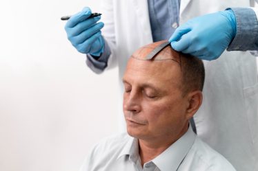 Protesi Capelli Uomo: Soluzione Innovativa per la Calvizie