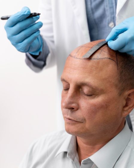 Protesi Capelli Uomo: Soluzione Innovativa per la Calvizie